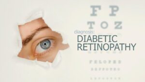 retinopatia diabetica